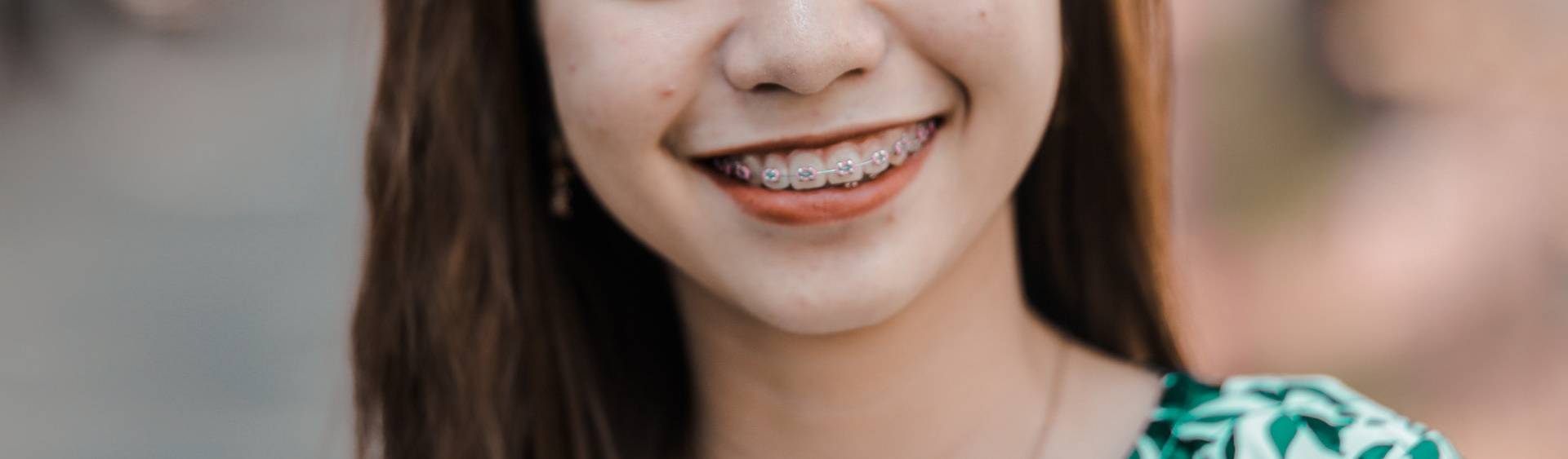 braces