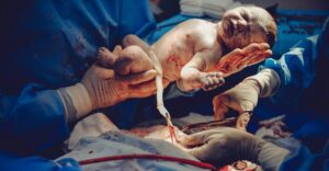 Birth Injuries