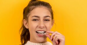 Clear Aligners