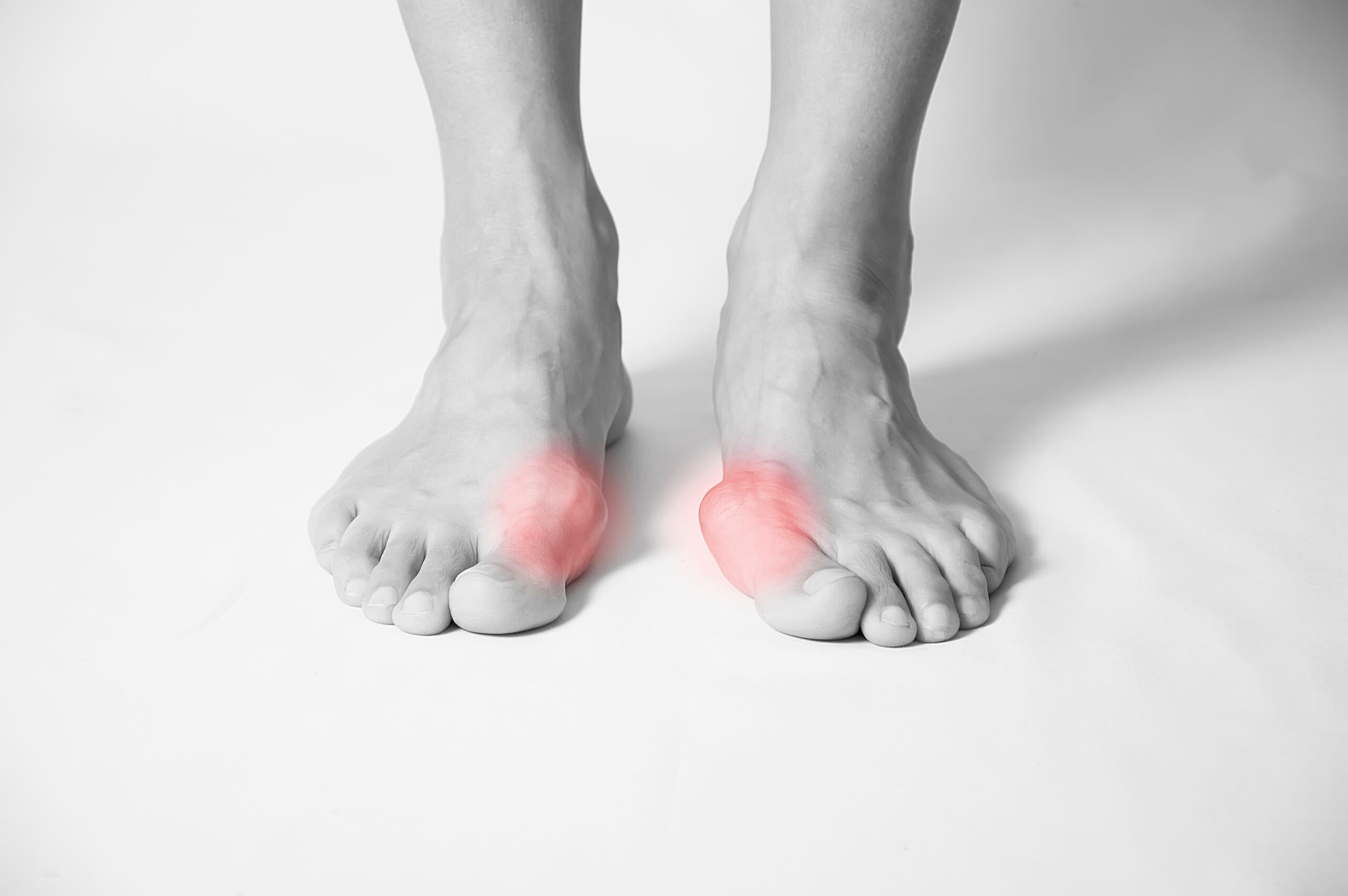 Foot pain in toes