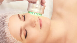 Fractional Radiofrequency